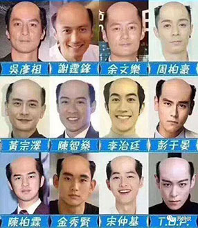 三千烦恼丝 明星也难免